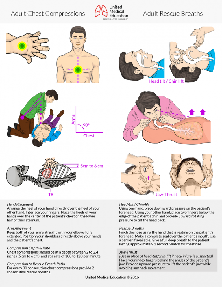 Adult-Chest-Compressions-and-Rescue-Breaths