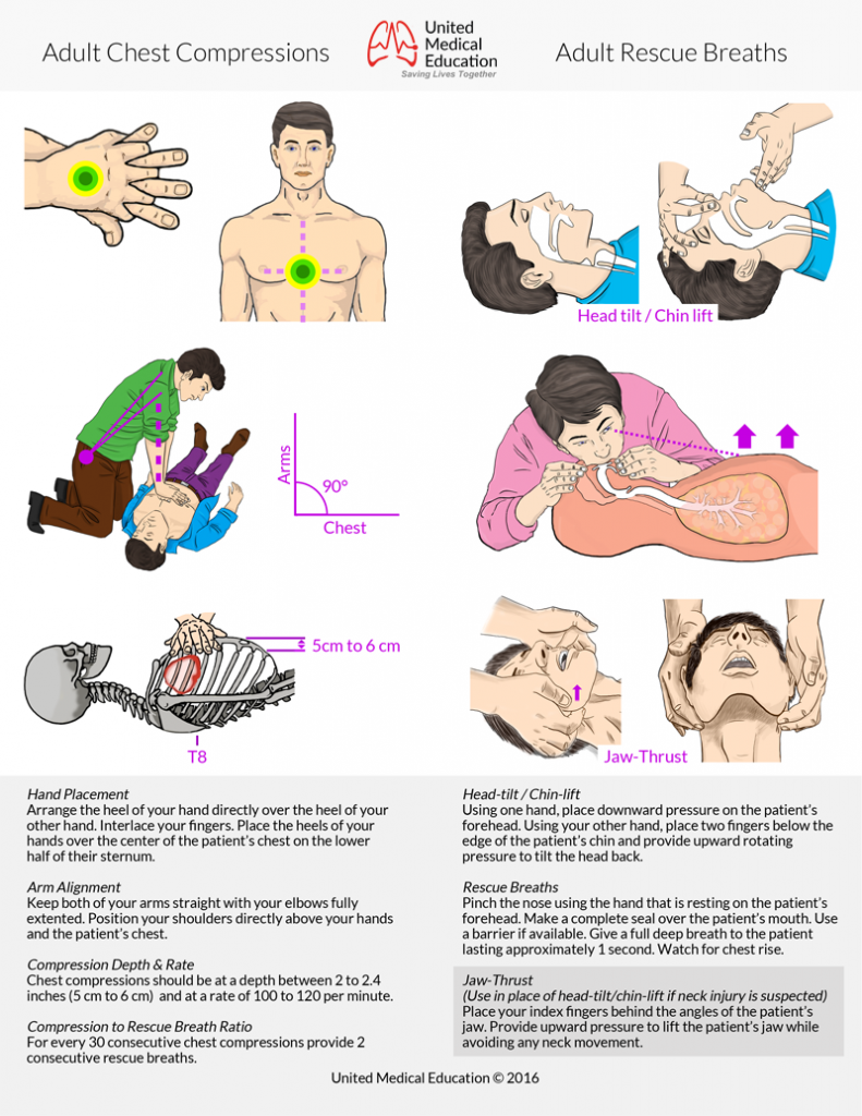 Adult-Chest-Compressions-and-Rescue-Breaths