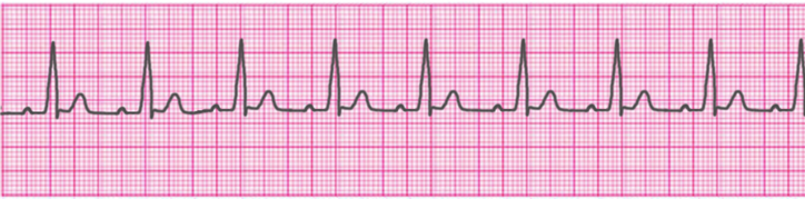 Normal Pediatric Vital Signs Chart