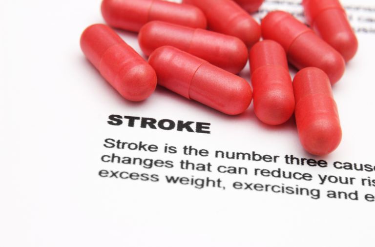 Top 10 Signs of a Stroke And What to Do