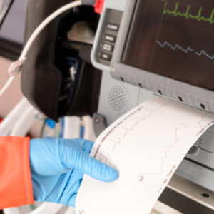 cardiac monitoring